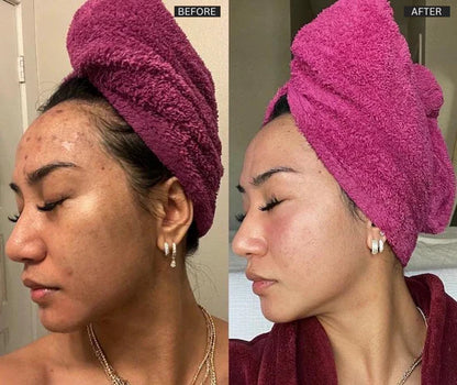 Turmeric & Kojic Acid Brightening Soap
